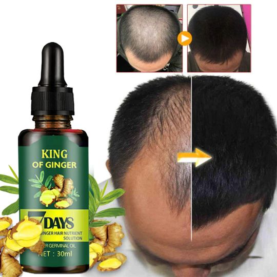 2pcs 7 Days Hair Growth Oil and Derma Roller