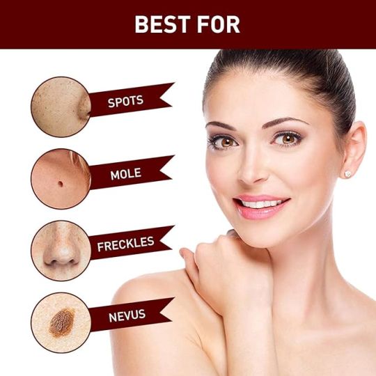 Wipe-off Mole and Tag Remover