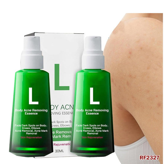 2PCS Acne Treatment Pimple Remover Serum RF2327-FD